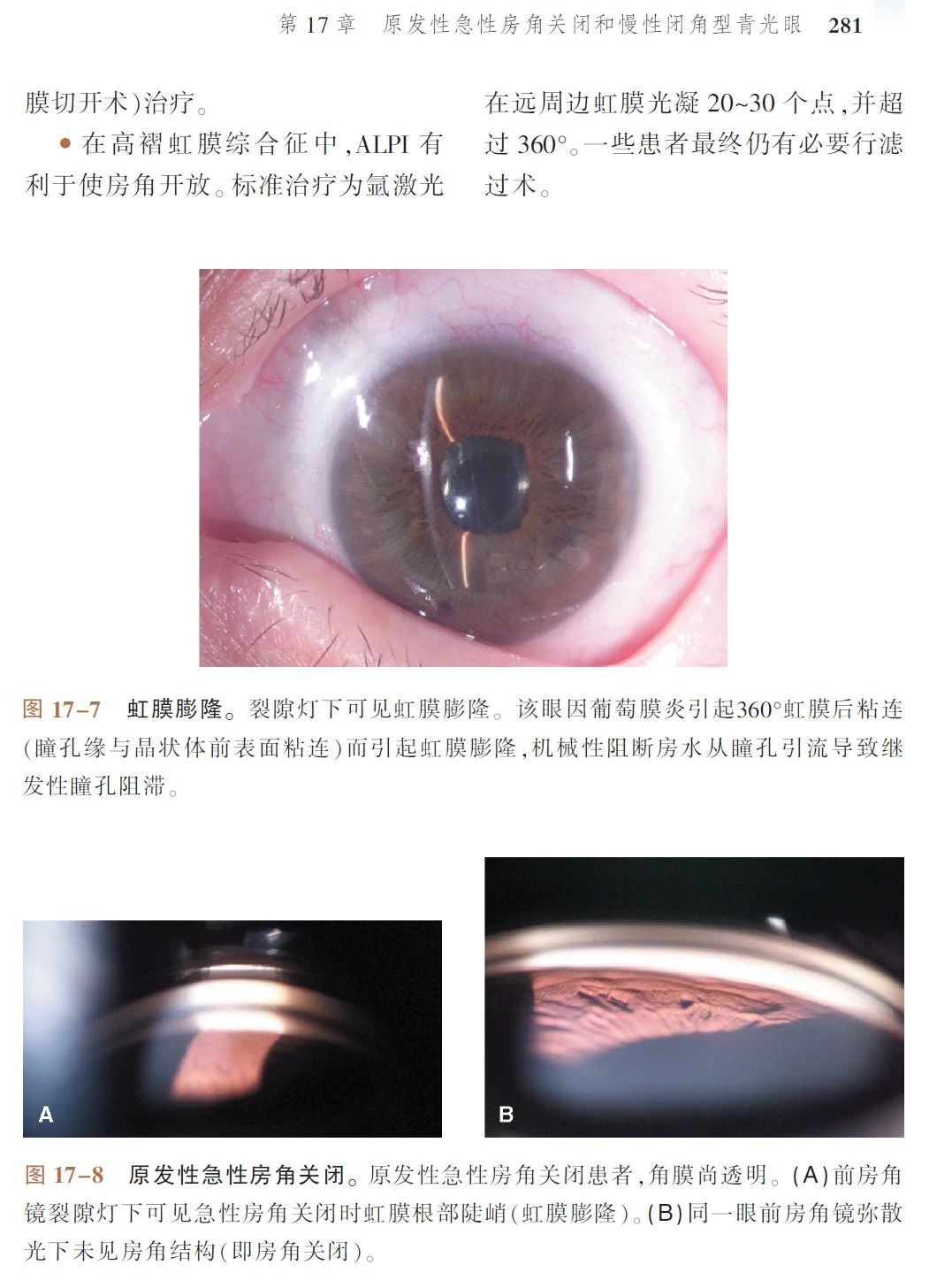 新書推薦 · 經(jīng)典好書——《Wills 臨床眼科彩色圖譜及精要：青光眼》