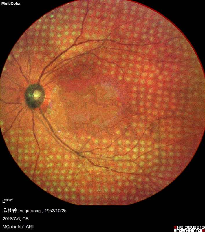 全國最佳民營眼科醫(yī)師彭志華：鉆研眼科激光術(shù)，一改“飛蚊”難困局_中國眼科網(wǎng)_yanke360.com